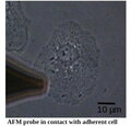 Endothelial cell mechanics